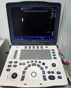 Lee más sobre el artículo Ecografía en podología