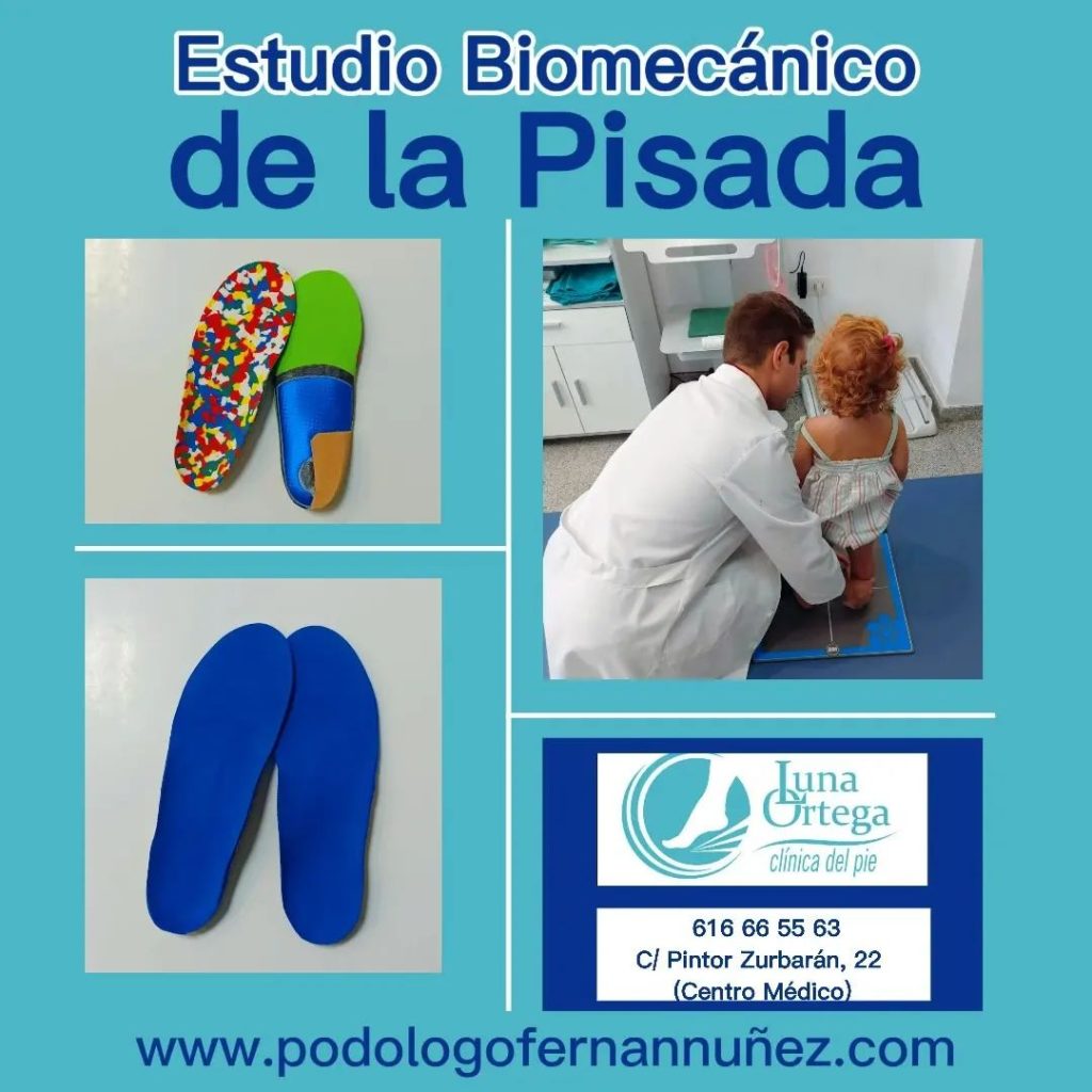 Estudio biomecánico de la pisada