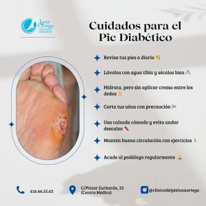 Lee más sobre el artículo Cuidados para el Pie Diabético