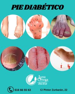 Lee más sobre el artículo ¡Atención personas con diabetes!