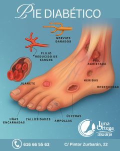 Lee más sobre el artículo Esta semana vamos a aprender sobre el pie diabético y cómo cuidarlo