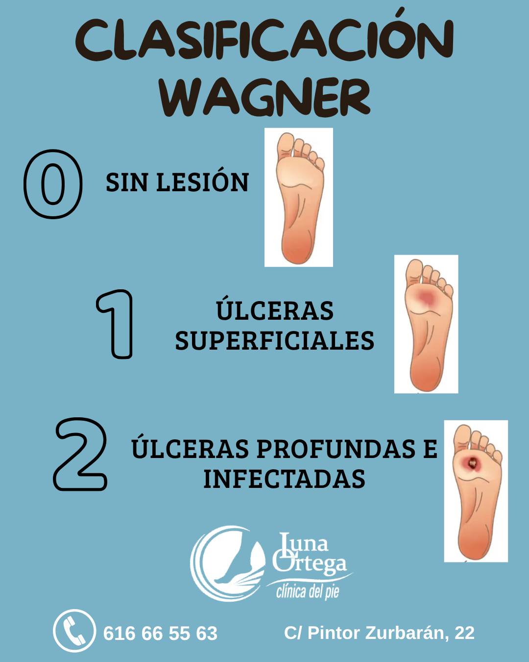 Lee más sobre el artículo La Clasificación de Wagner
